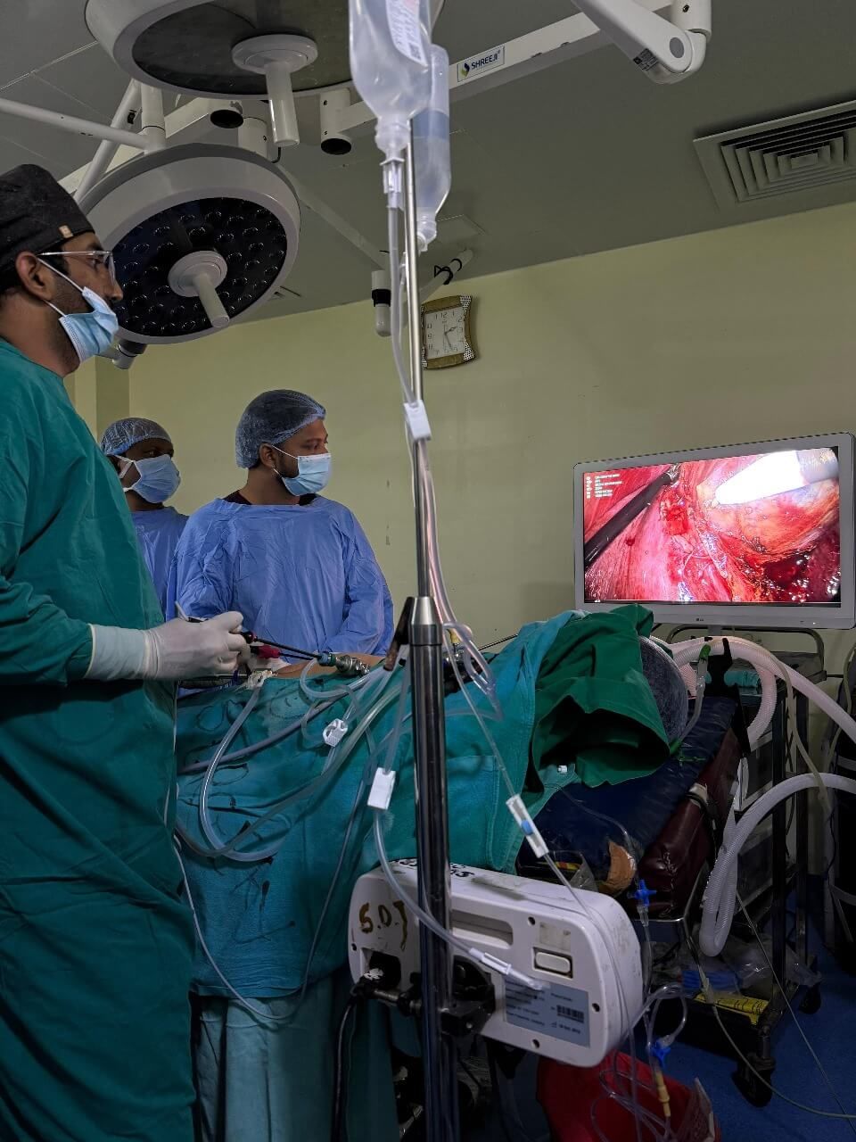 Laparoscopic surgery in progress in the operating theatre